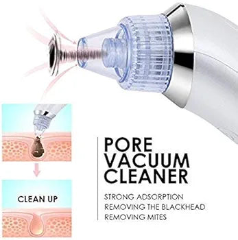 Whitehead Extractor Remover